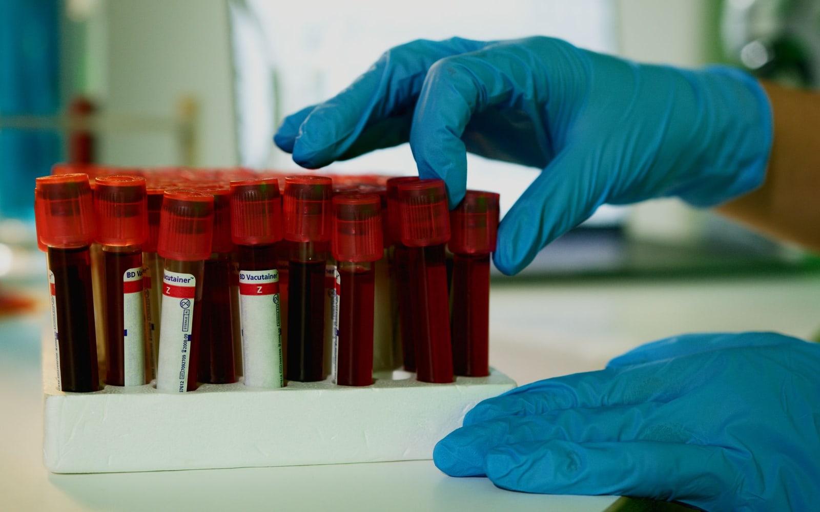 Gloved hands beside blood-sample tubes in a rack.